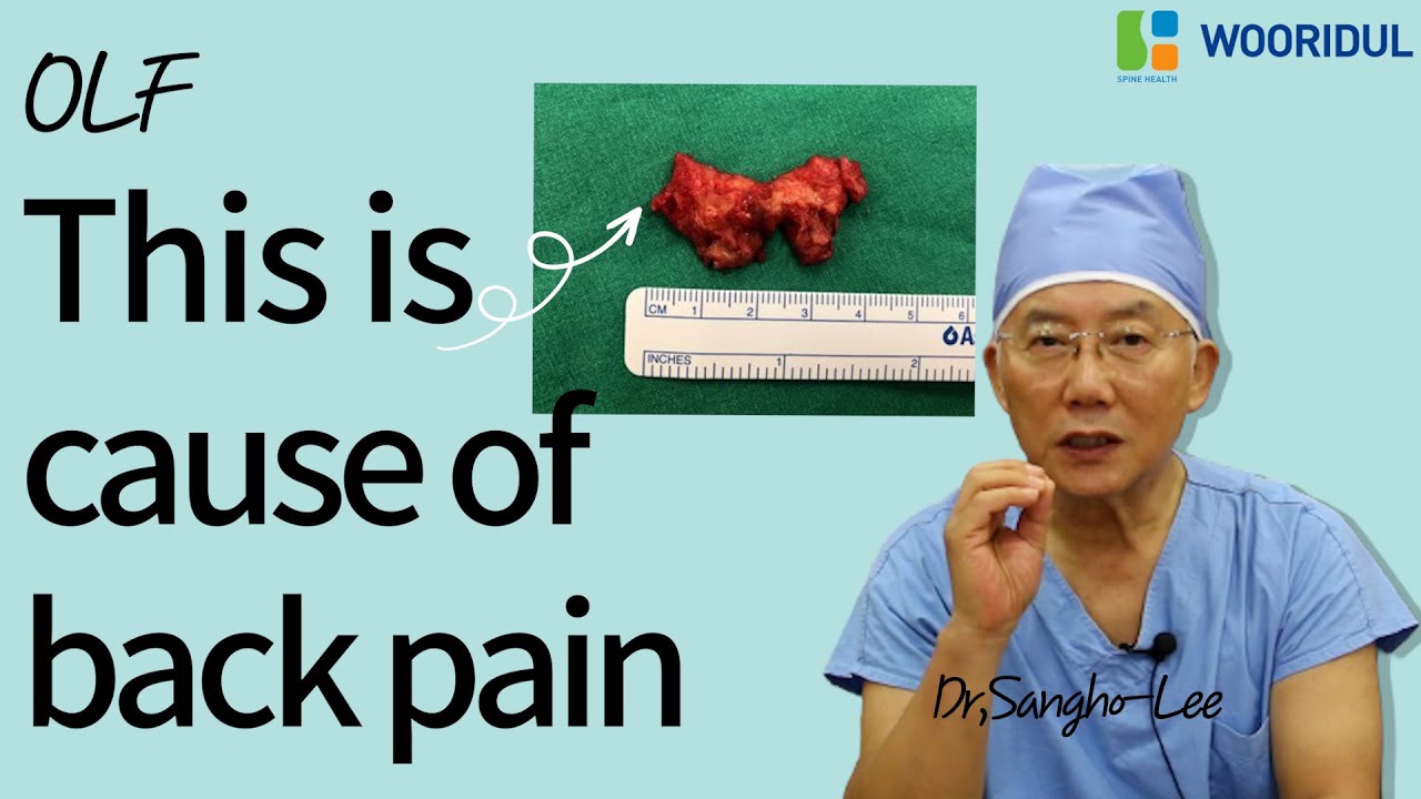 OLF (Ossification of ligament flavum)What is a cause of back pain?Wooridul developed own technique