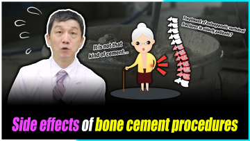 Bone Cement Procedure: What You Need to Know