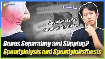 Understanding Spondylolysis and Spondylolisthesis