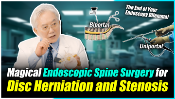 A Spine Surgery That Takes Only 15 Minutes?